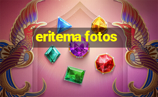 eritema fotos