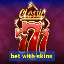 bet with skins