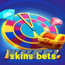 skins bets