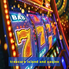 treasure island and casino